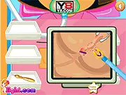 Dora Laparoscopic Appendectomy