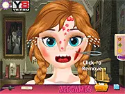 Anna Face Problems
