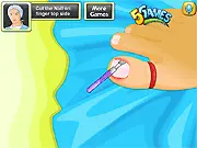 Ingrown Toenail Surgery