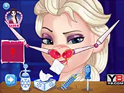 Elsa Nose Doctor