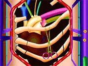 Emma Heart Valve Surgery